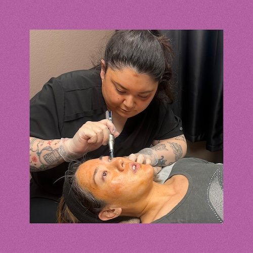 Exosome Treatment - $250 (reg. $300)